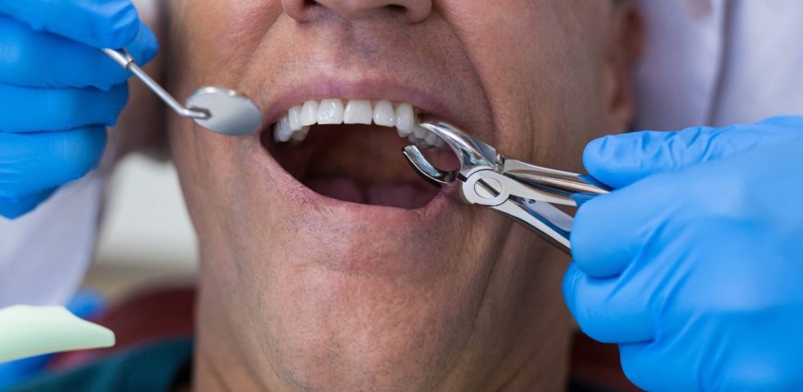 Полный гид по уходу за зубами после сложного удаления